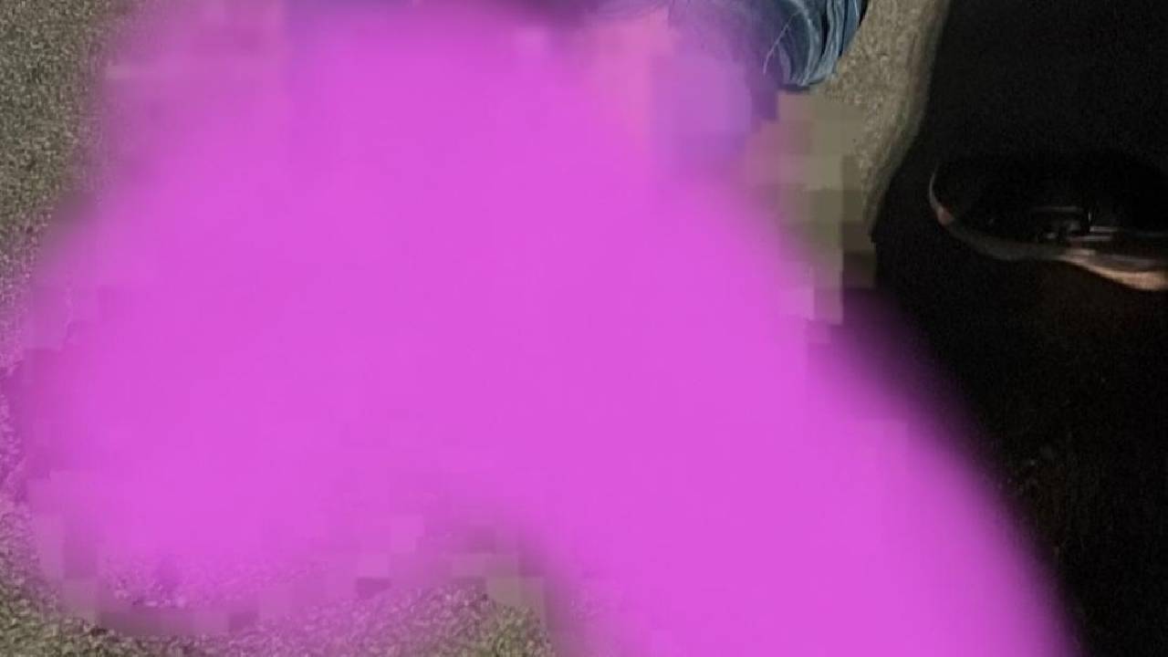 Acidente automobilístico deixa homem com perna decepada em Juazeiro-BA