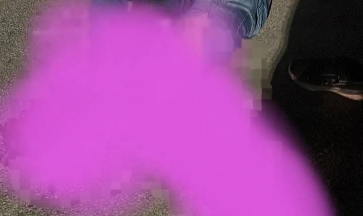 Acidente automobilístico deixa homem com perna decepada em Juazeiro-BA