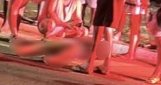 Acidente na BR-428, em Cabrobó-PE deixa mulher com fratura na perna