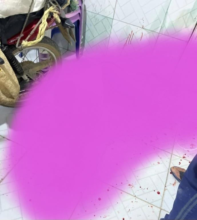 Homem fica gravemente ferido ao ser esfaqueado na zona rural de Sento Sé-BA